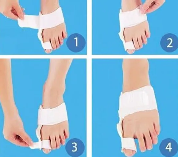 Valgus Teencorrector Verhelpt scheefstand van je Grote Teen Pijnloos - Afbeelding 4
